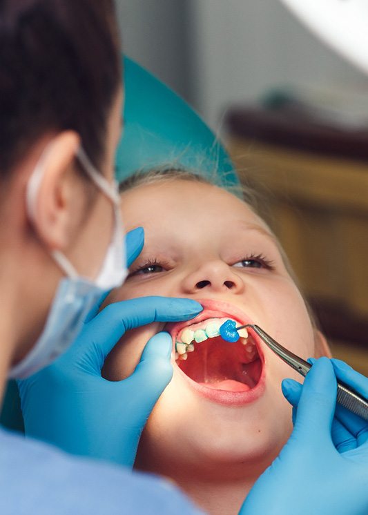A child getting fluoride treatment from a dentist