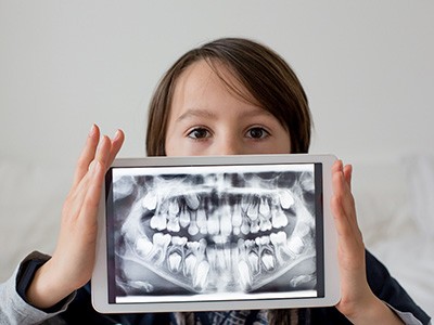 A boy holding a tablet with a dental X-ray on it