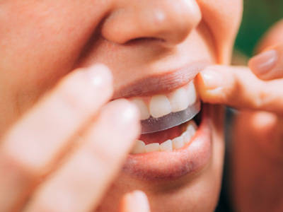 Woman using a teeth whitening strip